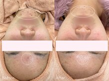 ミュー 栄本店(mieux)/お客様Before/After