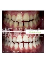 ホワイトニングサロン 札幌店/【ホワイトニング】#札幌#大通り