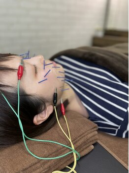 ヒトノワ(hitonowa)の写真/もう鏡を見るのが怖くない！肌や表情筋を熟知した国家資格者が贈る「電気美容鍼」であの頃のハリツヤを♪