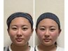 平日限定お試し木村の小顔骨格矯正+小顔マッサージ(ドライorオイル)¥9900