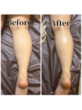 フィール(feel)/整体＋リンパ　Before & After