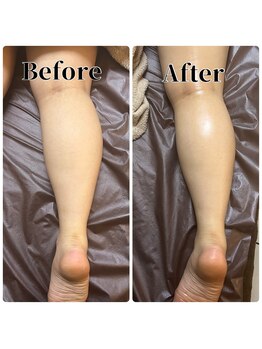 フィール(feel)/整体+リンパ Before & After
