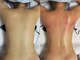 epani　Beauty Salonの写真/大人女性の頑固なセルライトや脂肪を徹底ケア！驚くほど見た目が変わる、理想の美しいボディラインへ。