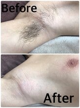 ブラジリアンワックス脱毛サロン ルラ 横浜(Lula)/男性にも大人気！