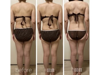 プラム(Plum in fortune lapis)/オイルトリートメント骨盤矯正