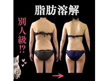 チェイン オブ フラワー(Chain Of Flower)の雰囲気（脂肪撃退し、筋膜リリースでスッとキュッとすっきり整ったBODYへ）