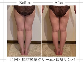 アルム(ALUM)/美脚を目指すなら→下半身60分