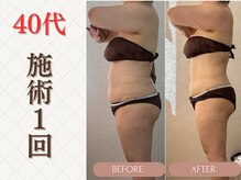 ミヨンビー(miyong.B)