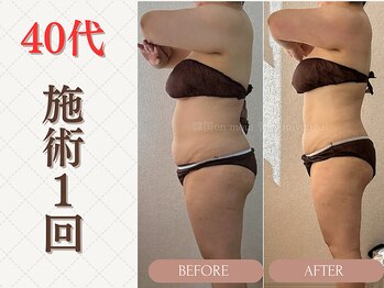 ミヨンビー(miyong.B)