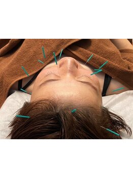 お肌をきれいにしたい