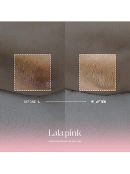 グラッソ(GRASSO)/ララピンク