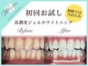 【岡崎初！】高濃度プレミアセルフホワイトお試し★1照射+コーティング付き