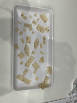 ウルト アルティメイトスキン(ULT ultimate skin)/ホワイトラボで取れる