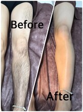 ブラジリアンワックス脱毛サロン ルラ 横浜(Lula)/男性も即日ツルスベ肌に