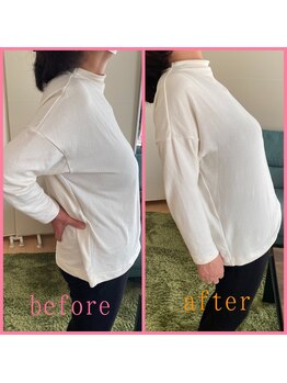 リセットモア(Reset More)/before after 1回の施術で