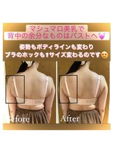 カドモリ 恵比寿代官山(KADOMORI)/マシュマロ美乳 Before After