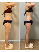 ジェニー(JENNI)/痩身70分