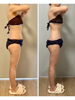 ジェニー(JENNI)/痩身70分