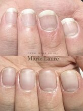マリーロール 天王寺店(Marie Laure)/自爪育成/深爪矯正/ネイルケア