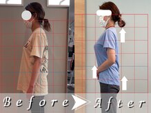 リガクスタイル 明石大久保(RIGAKUSTYLE)/猫背の原因は○○だった！