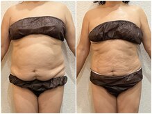 美容整体ウェリナ あま甚目寺院/小顔矯正/骨盤矯正/美脚サロン