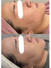 パリスヒロトン(PARIS HIROTON)/アンストレスサロンケア