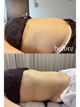 カーム(CALM.)/ダイエットコースの方のお腹