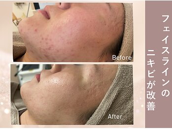 エヴァル(ewalu)/ー 6ヶ月の変化 ー