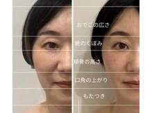 ドクターボディクリスタル(Dr.Body Crystal)の雰囲気（独自のハンド技術と最新マシンでたるみ改善）