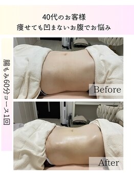 リュクス(LUXE)/大人気の腸もみ