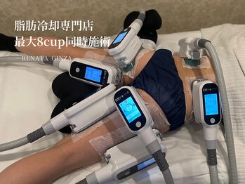 レナータ 銀座店(RENATA)の写真/【脂肪冷却専門RENATA銀座店】
最大8cup同時施術で効率的な全身ケア