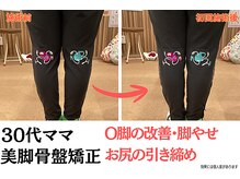 ニノ治療院(Nino治療院)の雰囲気（産後の悩みで多いO脚も改善できます！下半身痩せもお任せ☆）