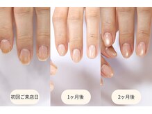 イズ(...is)の雰囲気（【丁寧なケア】傷んでしまった爪を本来の爪へ導く）