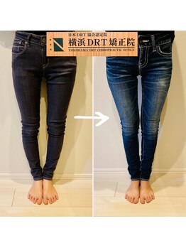 横浜DRT矯正院/O脚矯正