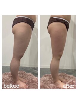 ファビリス 仙台ロフト店(FAVILIS)/【痩身】キャビリポ60分1回