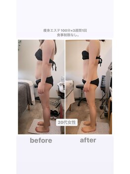 トランキーロ(Tranquilo)/ブライダルエステにおすすめ