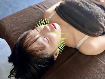 クリアランス 南青山(CLEARANCE)/美容鍼