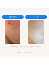 ムーンライズ(moonrise)/