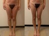 美脚＆美尻2回コース/浮腫/頑固な凸凹セルケア 硬い脂肪も◎