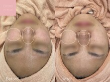 ミュー 栄本店(mieux)/お客様Before/After