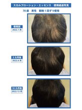 スキンラボ カホクカイ(KaHokuKai)/幅広い年齢層に効果あります