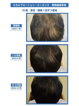 スキンラボ カホクカイ(KaHokuKai)/幅広い年齢層に効果あります