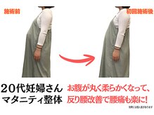 ニノ治療院(Nino治療院)の雰囲気（妊娠中の腰痛や骨盤の痛み、お腹の張りといった悩みもお任せ！）