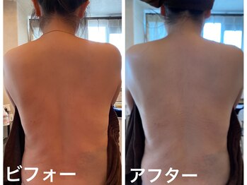 ナオフクオカ ヒーリングフォースエヌ(NaoFukuoka/healingforceN)/姿勢美人になりませんか?