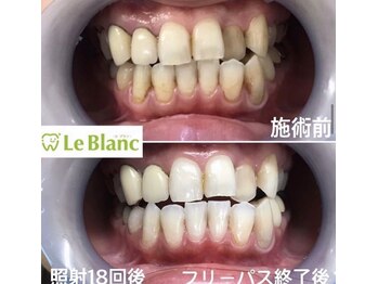 ルブラン 奈良店(Le Blanc)/お得なフリーパス