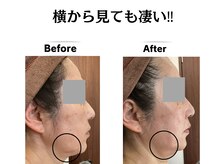 グレースティー 森町 箕面/横顔のフェイスラインもスッキリ