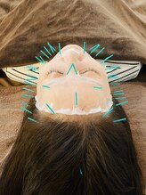 リハリ 本町院(///Rehari)/ヒト幹細胞オーダー美容鍼