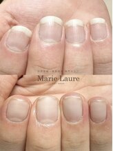 マリーロール 天王寺店(Marie Laure)/自爪育成/深爪矯正/ネイルケア