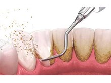 エクシアホワイトニング 日本橋店/クリーニング