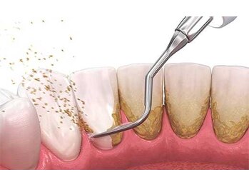 エクシアホワイトニング 日本橋店/クリーニング